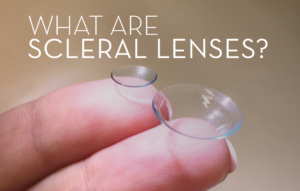 Scleral lenses in Chicago