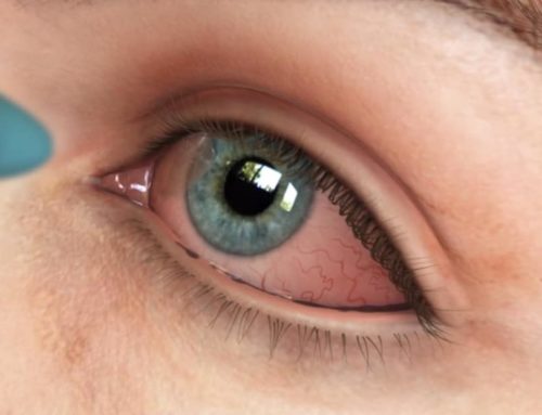 Eye Infections: Symptoms and Treatments You Need to Know