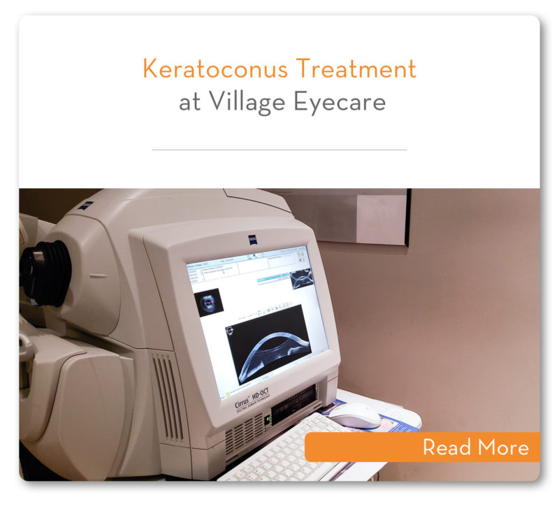 Keratoconus Treatment Village Eyecare