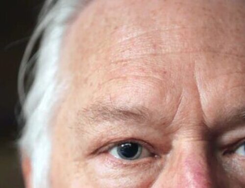 What to Expect During a Dilated Eye Exam | Why It Matters