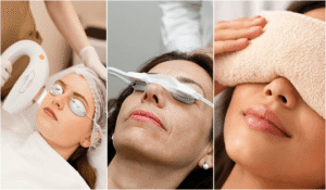 LipiFlow-vs-IPL-vs-Warm-Compresses