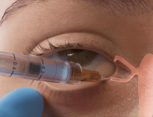 Lacrifill vs Punctal Plugs: Dry Eye Treatment Guide