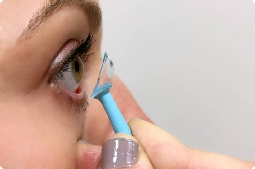 Patient inserting a scleral lens